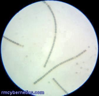 Microscopic view of surface algae (phytoplankton)